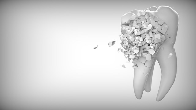 Jak dentyści naprawiają wyszczerbione zęby